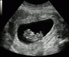 Ultrasound_Scan_ND_0105143736_1439320.gif