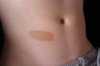 birthmark-on-the-stomack.jpg